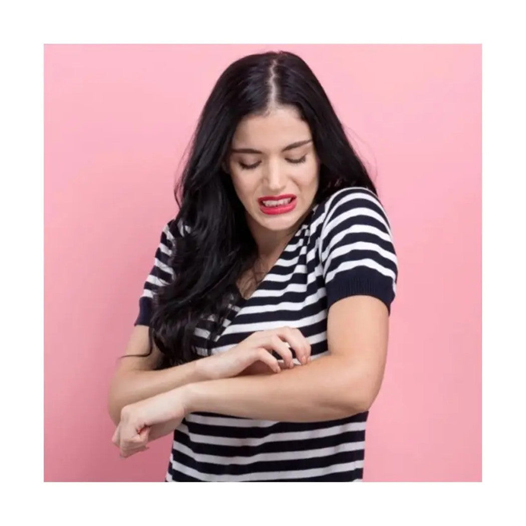 12 stücke ab 20 Beiträge Pfosten Punktion Patch Relief Beruhigender Juckreiz